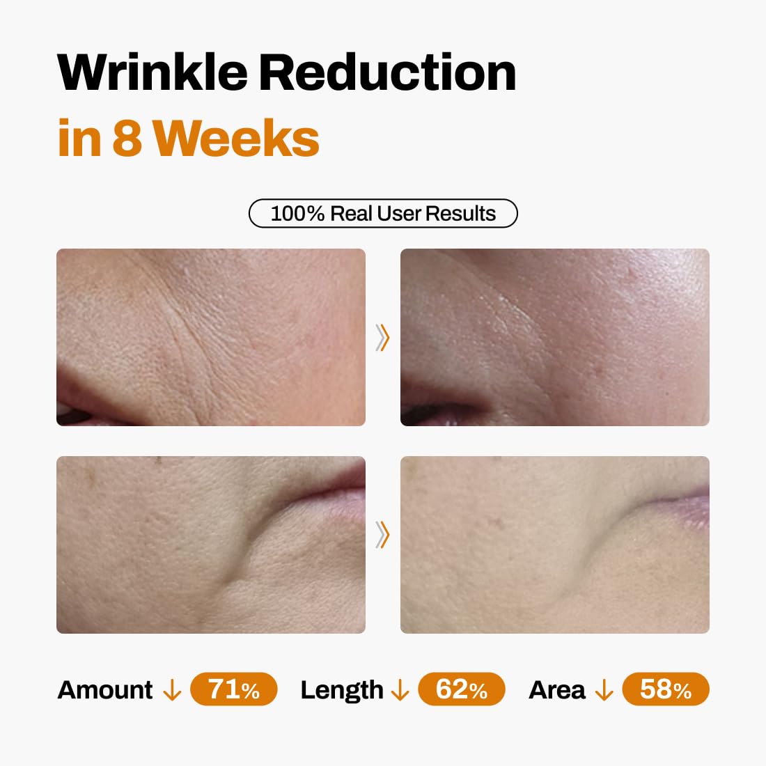 TimeLift Anti-Aging System