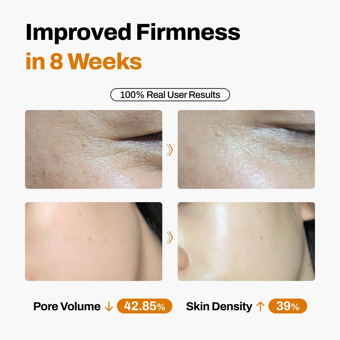 TimeLift Anti-Aging System