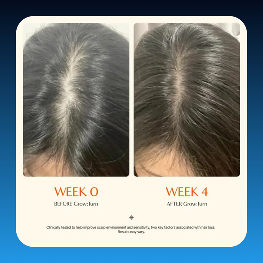Hair Growth Scalp & Thickening Serum with Built-In Brush Applicator