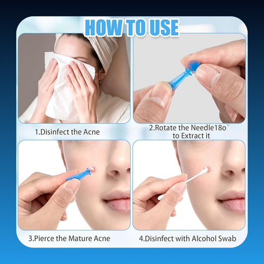 Disposable Pore Pimple Remover