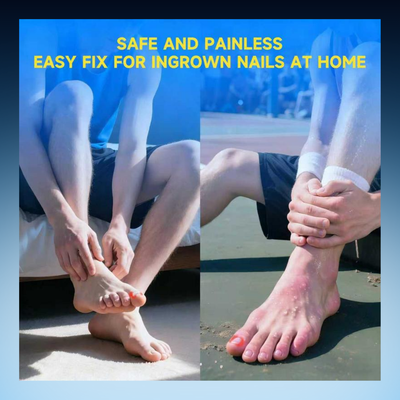 Ingrown Toenail Correction Strips