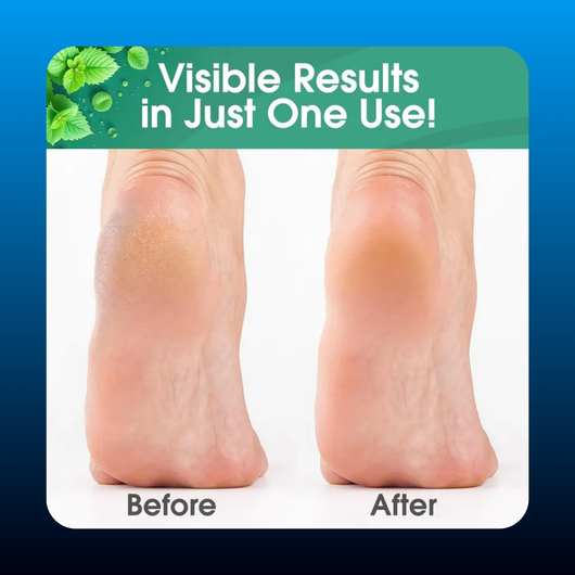 Callus Maintenance Pack