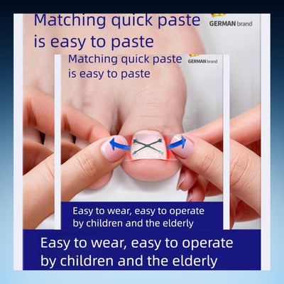 Ingrown Toenail Correction Strips