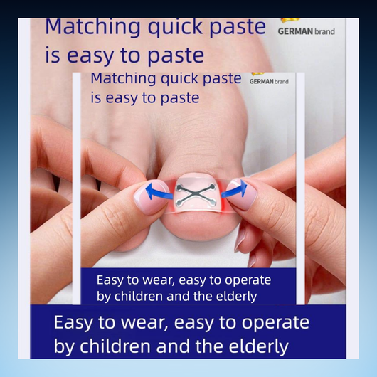 Ingrown Toenail Correction Strips