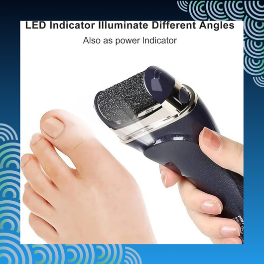 Electric Callous Remover
