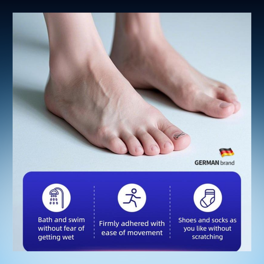 Ingrown Toenail Correction Strips