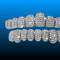 Silver Plated Hip Hop Teeth Grillz