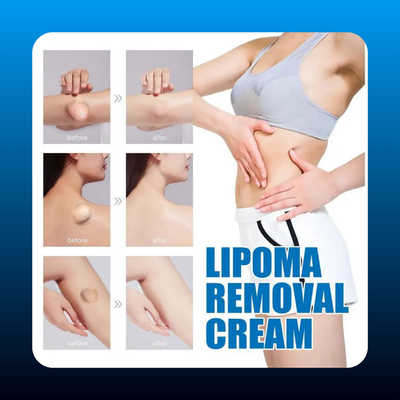 Lipoma Relieving Lump Cream