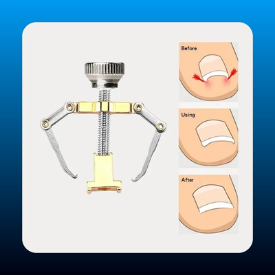 Ingrown Toenail Lifter Tool