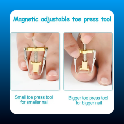 Ingrown Toenail Lifter Tool
