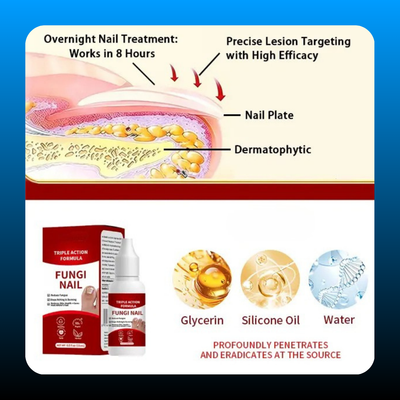 Antifungal Solution for Toenail and Fingernail