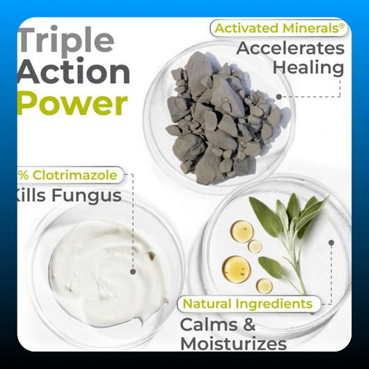 Antifungal Cream for Fungal Yeast Infections
