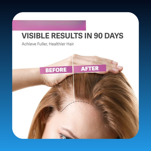 Biotin Hair Gummies