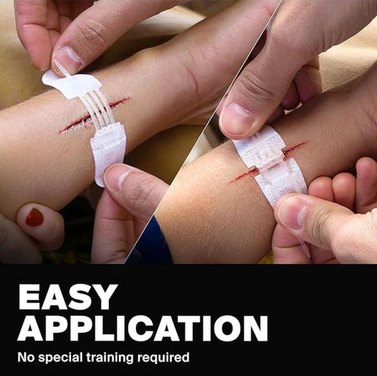 HealZip Wound Kit