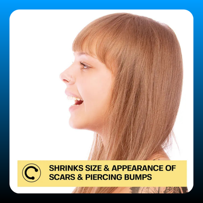 Piercing Bump Solution
