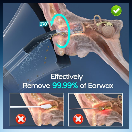 Electric Ear Wax Removal Irrigation System