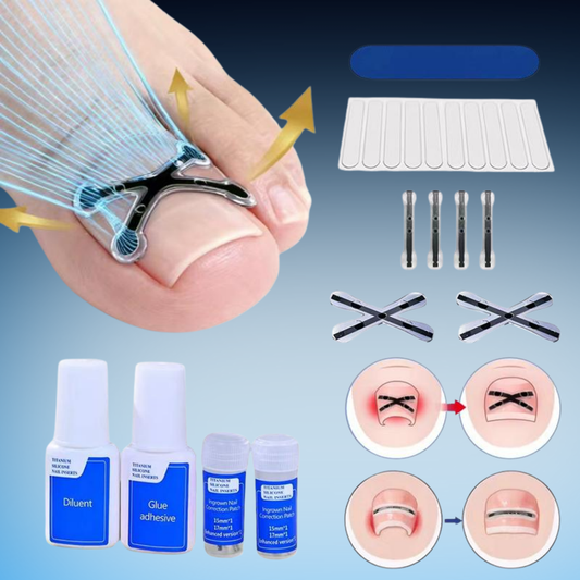 Ingrown Toenail Correction Strips