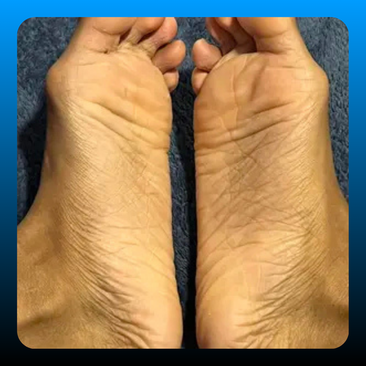 Dry Foot and Heel Rescue Ointment