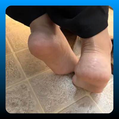 Dry Foot and Heel Rescue Ointment
