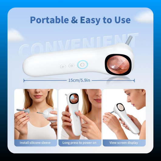 Smart Professional Ear Wax Removal Tool for Home