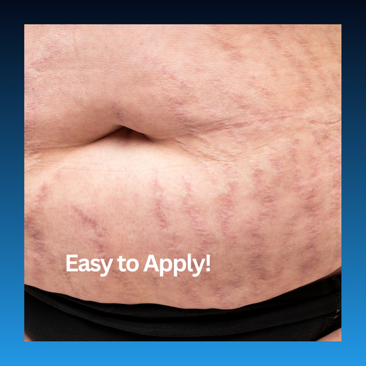 Stretch Mark Corrector