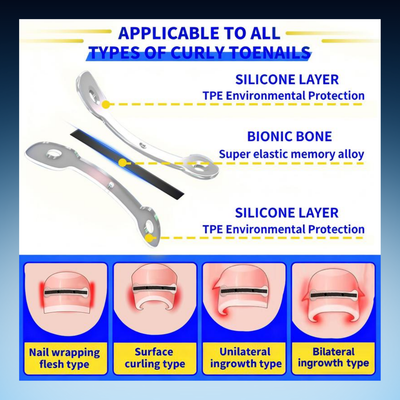 Ingrown Toenail Correction Strips