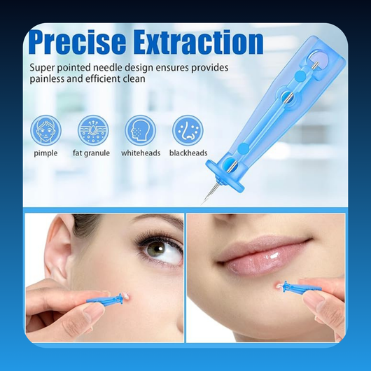 Disposable Pore Pimple Remover