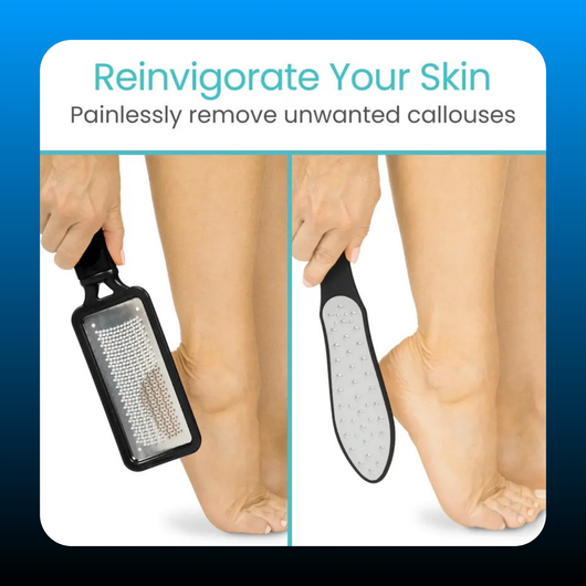 3 Pack Foot File Feet Scraper