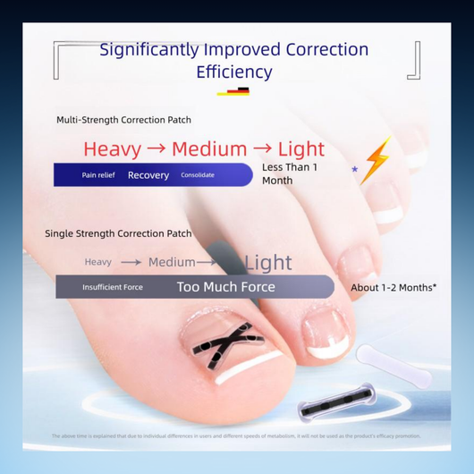 Ingrown Toenail Correction Strips