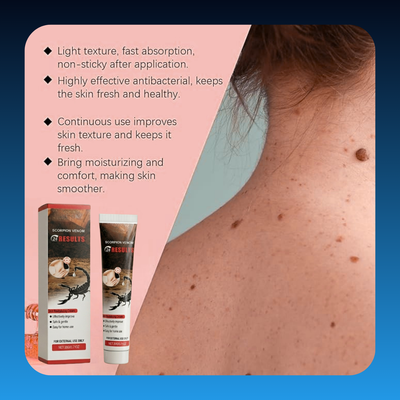 Powerful Wart Eliminator Cream