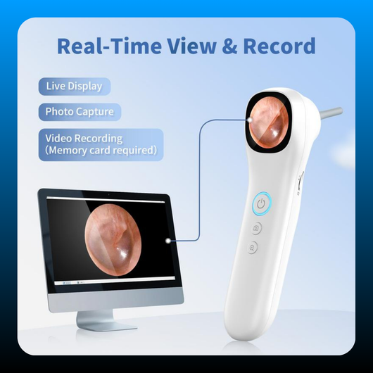 Smart Professional Ear Wax Removal Tool for Home