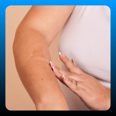 S-Resilience Stretch Marks Oil