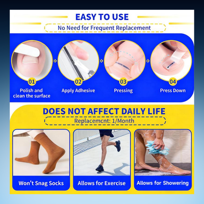 Ingrown Toenail Correction Strips