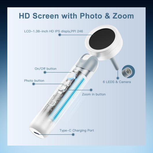 HD Digital Otoscope with LCD Screen
