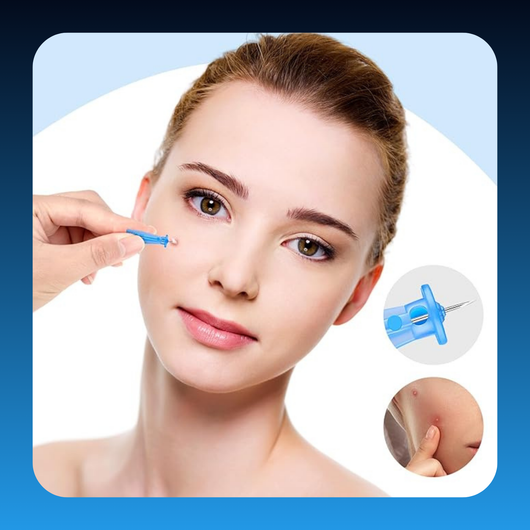 Disposable Pore Pimple Remover