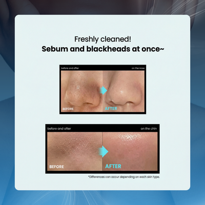 Deep Clean Pore & Blackhead Remover