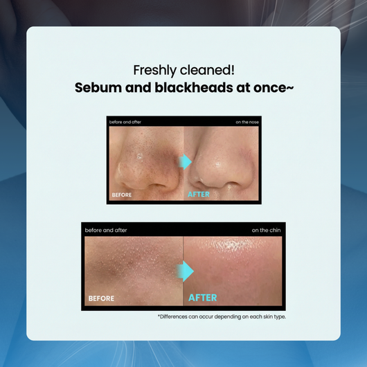Deep Clean Pore & Blackhead Remover