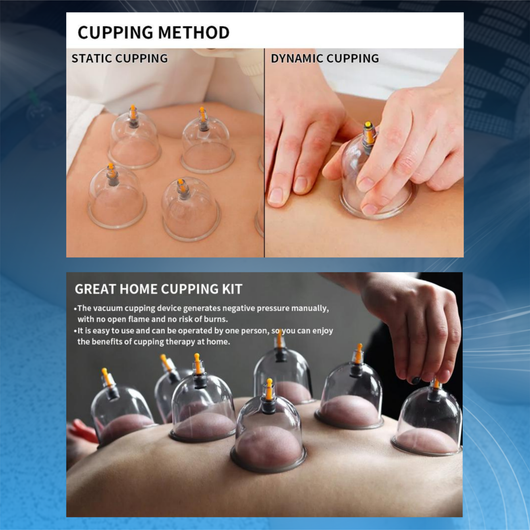 Cupping Therapy Kit for Muscle Relief and Cellulite