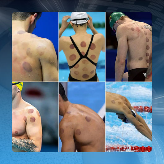 Cupping Therapy Kit for Muscle Relief and Cellulite