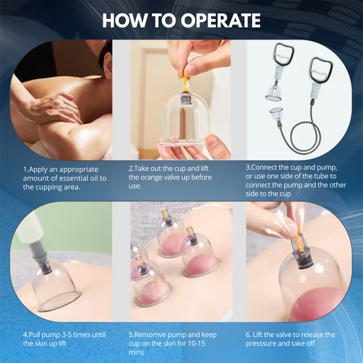Cupping Therapy Kit for Muscle Relief and Cellulite