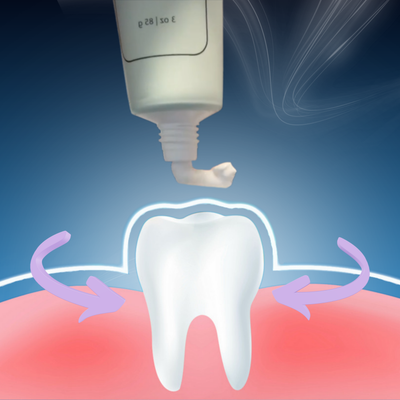 Hydroxyapatite Protection
