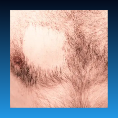 Long-Lasting Smoothness