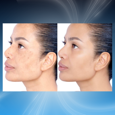 Visible Skin Smoothing