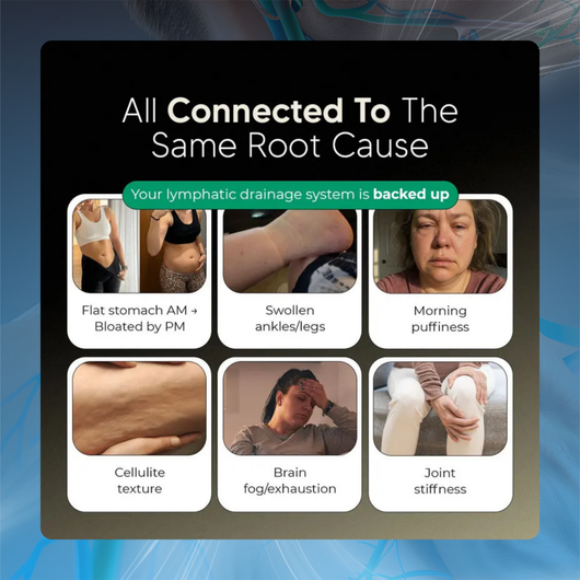 Lymphatic Cleanse and Support Capsules