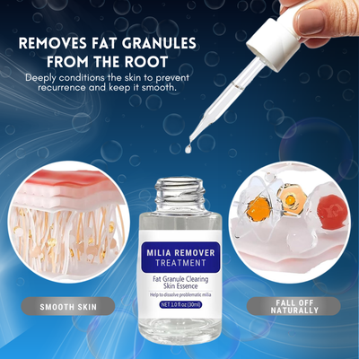 Advanced Milia Remover Serum