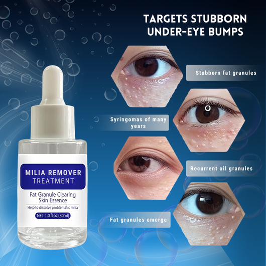 Advanced Milia Remover Serum