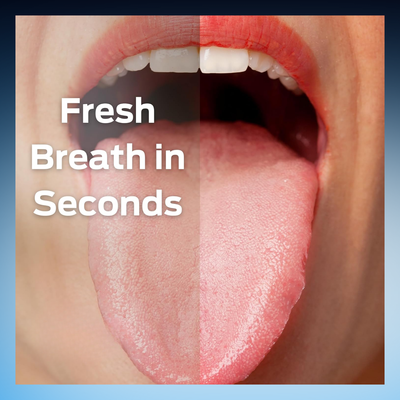 Tongue Cleaner