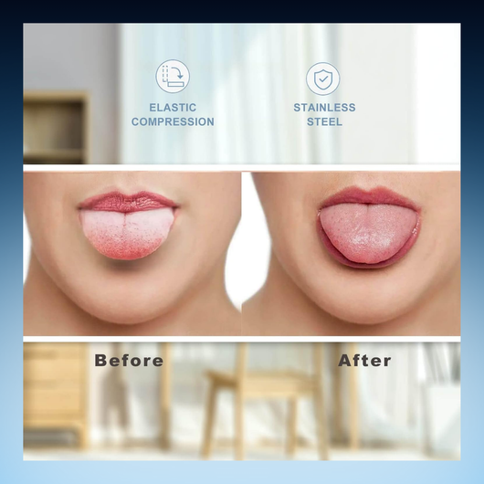 Tongue Cleaner
